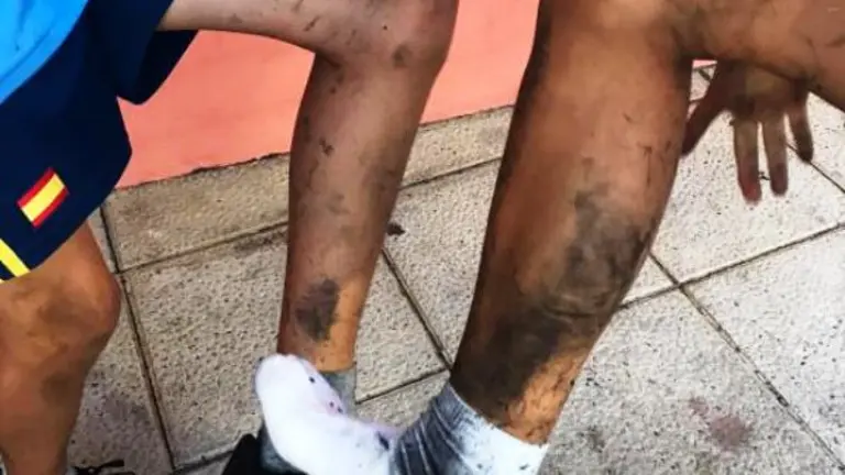 Usuarios afectados por el caucho.