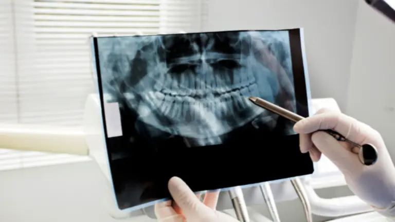 Las revisiones han comenzado hoy, lunes, día 4 de noviembre.